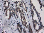 ACY3 Antibody in Immunohistochemistry (Paraffin) (IHC (P))