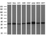 ACY3 Antibody in Western Blot (WB)