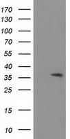 ACY3 Antibody in Western Blot (WB)