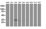 ACY3 Antibody in Western Blot (WB)