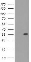 ACY3 Antibody in Western Blot (WB)