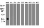 ACY3 Antibody in Western Blot (WB)