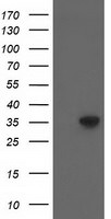 ACY3 Antibody in Western Blot (WB)