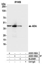 ADA/Adenosine Deaminase Antibody in Western Blot (WB)