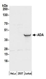 ADA/Adenosine Deaminase Antibody in Western Blot (WB)