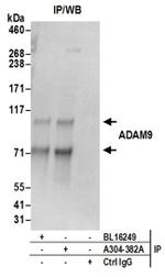 ADAM9 Antibody in Western Blot (WB)