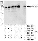 ADAMTS13 Antibody in Immunoprecipitation (IP)