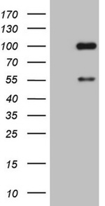 ADAMTS4 Antibody in Western Blot (WB)