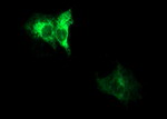 ADAMTS8 Antibody in Immunocytochemistry (ICC/IF)