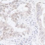 ADAR1 Antibody in Immunohistochemistry (IHC)