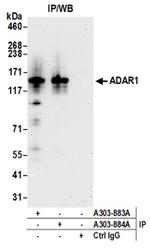 ADAR1 Antibody in Western Blot (WB)