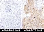 ADE2 Antibody in Immunohistochemistry (IHC)