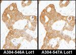 ADE2 Antibody in Immunohistochemistry (IHC)