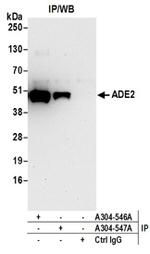 ADE2 Antibody in Western Blot (WB)