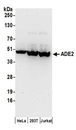 ADE2 Antibody in Western Blot (WB)