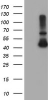 ADH7 Antibody in Western Blot (WB)