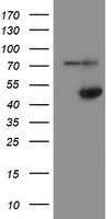 ADH7 Antibody in Western Blot (WB)