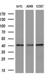 ADH7 Antibody in Western Blot (WB)