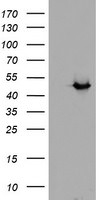 ADH7 Antibody in Western Blot (WB)