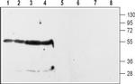 D2 Dopamine Receptor (extracellular) Antibody in Western Blot (WB)
