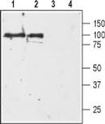 D3 Dopamine Receptor (extracellular) Antibody in Western Blot (WB)