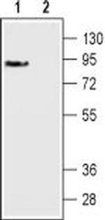 D3 Dopamine Receptor (extracellular) Antibody in Western Blot (WB)