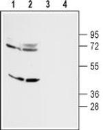 D4 Dopamine Receptor Antibody in Western Blot (WB)