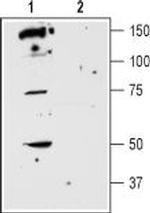 D5 Dopamine Receptor (extracellular) Antibody in Western Blot (WB)
