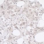 ADRM1 Antibody in Immunohistochemistry (IHC)