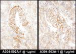 AE2 Antibody in Immunohistochemistry (IHC)