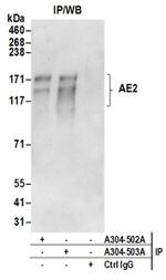 AE2 Antibody in Western Blot (WB)