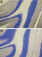 Endothelin Receptor A Antibody in Immunohistochemistry (Paraffin) (IHC (P))