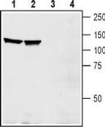 EphA1 (extracellular) Antibody in Western Blot (WB)