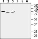 GPER1/GPR30 (extracellular) Antibody in Western Blot (WB)