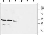 GPER (GPR30) Antibody in Western Blot (WB)
