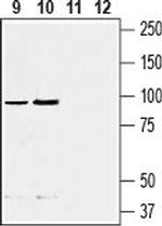 EMR1 (ADGRE1) (extracellular) Antibody in Western Blot (WB)