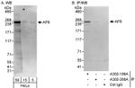 AF6 Antibody in Western Blot (WB)