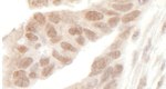 AF9 Antibody in Immunohistochemistry (IHC)