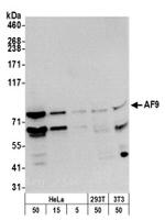AF9 Antibody in Western Blot (WB)