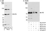 AF9 Antibody in Western Blot (WB)