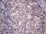 AFAP1 Antibody in Immunohistochemistry (Paraffin) (IHC (P))