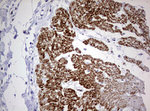 AFAP1 Antibody in Immunohistochemistry (Paraffin) (IHC (P))