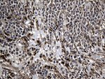 AFAP1 Antibody in Immunohistochemistry (Paraffin) (IHC (P))