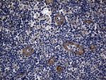 AFAP1 Antibody in Immunohistochemistry (Paraffin) (IHC (P))