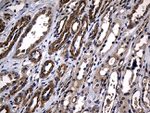 AFAP1 Antibody in Immunohistochemistry (Paraffin) (IHC (P))