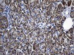 AFAP1 Antibody in Immunohistochemistry (Paraffin) (IHC (P))