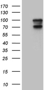 AFAP1 Antibody in Western Blot (WB)