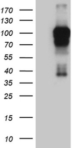 AFAP1 Antibody in Western Blot (WB)