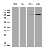 AFAP1 Antibody in Western Blot (WB)