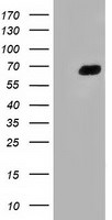 AFP Antibody in Western Blot (WB)